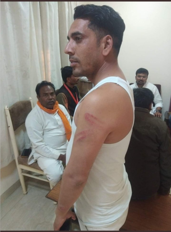 MithunPatle12's tweet image. ओबीसी महासभा के कार्यकर्ताओं के ऊपर किस प्रकार से घमंडी @ChouhanShivraj जी की पुलिस प्रशासन ने लाठीचार्ज किया और उसमें कार्यकर्ता घायल हुए याद रखना घमंड रावण का भी नहीं रहा तो ध्यान दीजिए ओबीसी वर्ग की ओर भरना इसका खामियाजा भुगतना पड़ेगा आपको याद रखिएगा @OBC_MP @Durgeshpatelinc