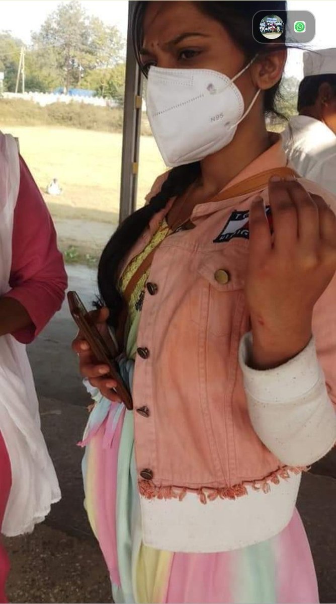 MithunPatle12's tweet image. ओबीसी महासभा के कार्यकर्ताओं के ऊपर किस प्रकार से घमंडी @ChouhanShivraj जी की पुलिस प्रशासन ने लाठीचार्ज किया और उसमें कार्यकर्ता घायल हुए याद रखना घमंड रावण का भी नहीं रहा तो ध्यान दीजिए ओबीसी वर्ग की ओर भरना इसका खामियाजा भुगतना पड़ेगा आपको याद रखिएगा @OBC_MP @Durgeshpatelinc