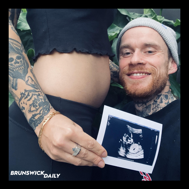 Brunswick_Daily's tweet photo. Chris never thought he’d be a runner. A follow up scan gave him and his partner confronting information about Gracie: her right arm was completely missing from the shoulder down. Chris started training and now he's running Melbourne's Marathon #melbmara  https://t.co/i8vIUWgiOK https://t.co/aTZTcgIgyY