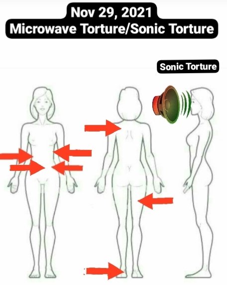 ti_nevada's tweet photo. Nov29/10:34pm (1543) Microwave Weapon #DEW #EMP #Torture and #HavanaSyndrome #SonicWeapon torture. #WarCrimes #HumanTrafficking @NilsMelzer #Maiming  #internalinjuries @marcorubio @DeptVetAffairs @RandPaul @CIA @SenatorShaheen https://t.co/JDS7A6YiHn