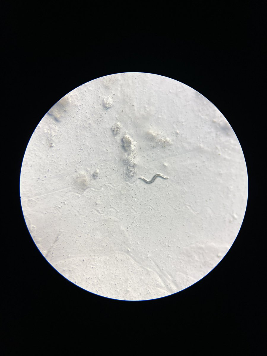 SSerenaDing's tweet photo. We had a super fun, albeit !freezing 🥶!, few days sampling with @wormlab_eu around the Lake Konstanz region. We looked at lake sediment, forest soil, and orchard fruits (featuring alpacas) and found some worms, including this wiggling male! 🪱 We need more ecology for worms! https://t.co/cVt3sINEvt