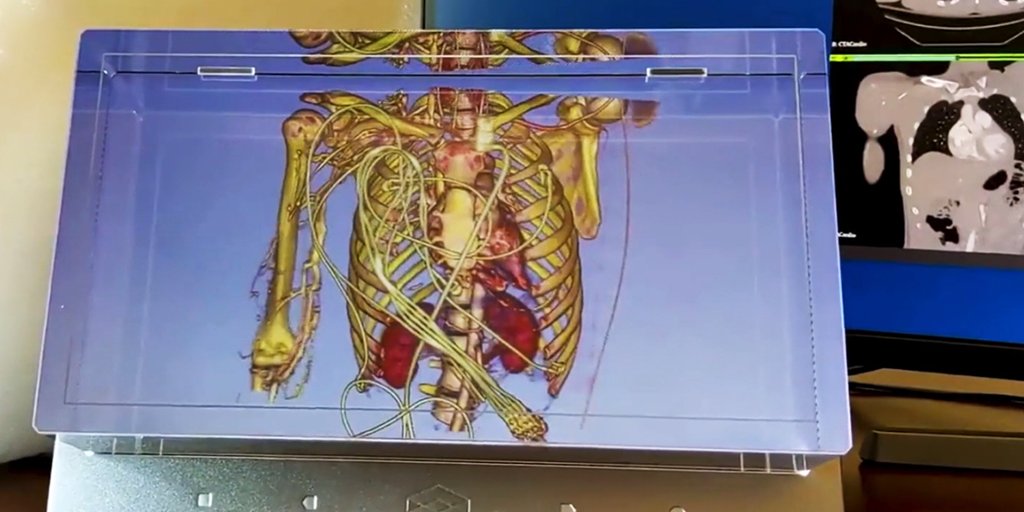 Kitware's tweet image. Looking for a way to manipulate and display your #medicaldata? #VTK is our open source platform that has  tools for 3D rendering, a suite of widgets for 3D interaction, and extensive 2D plotting capabilities. Schedule a meeting with us during #RSNA21 ow.ly/M9V750GTMzi