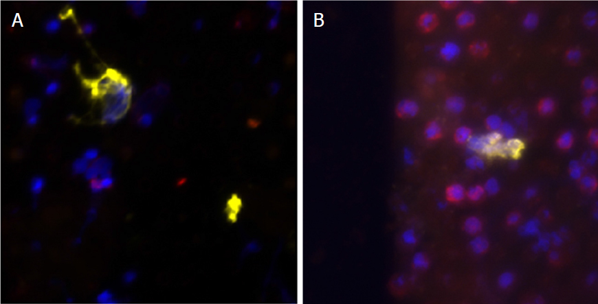 Cancer Drug Resistance tweet media