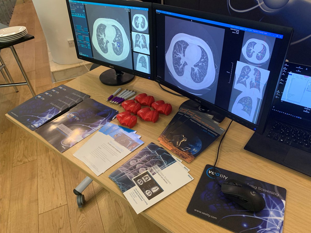 sarumpr's tweet photo. Here at the Govconnect Long Term Plan 2021 event in London with @SynAppsSol armed with our lung stress balls and talking to everyone about the MeVis Medical Solutions AG Veolity Lung Screening system #lungscreening https://t.co/T30g4lEJ5X