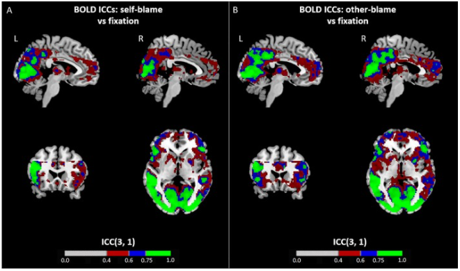 diedef92's tweet photo. Our fMRI paper (w/@roland_zahn, @GarethJBarkerUK, @JorgeMoll7, OO'Daly) looked at different measures of internal consistency of self-blame related measures - simple might be best in terms of reliability!
https://t.co/aYlU9UbMcc https://t.co/fiLdbHLnjU
