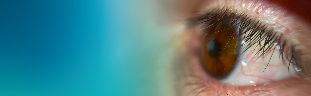 Fraunhofer_IGD's tweet image. Weltneuheit: Augenprothesen werden in Zukunft mit 3D-Druckern hergestellt. Unsere Software Cuttlefish:Eye nutzt einen 3D-Scan der Augenhöhle und ein farbkalibriertes Foto des gesunden Auges, um das 3D-Modell des Prothesenauges zu erstellen. 

👉 igd.fraunhofer.de/presse/aktuell…