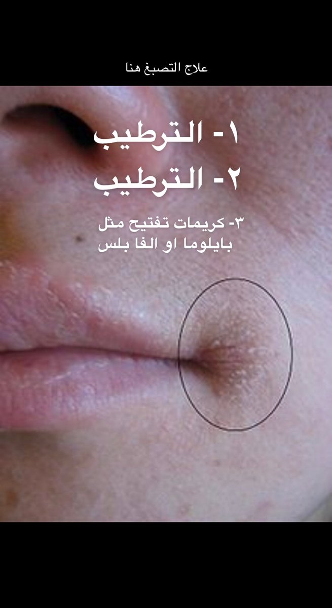 د.مانع الحربي tweet media