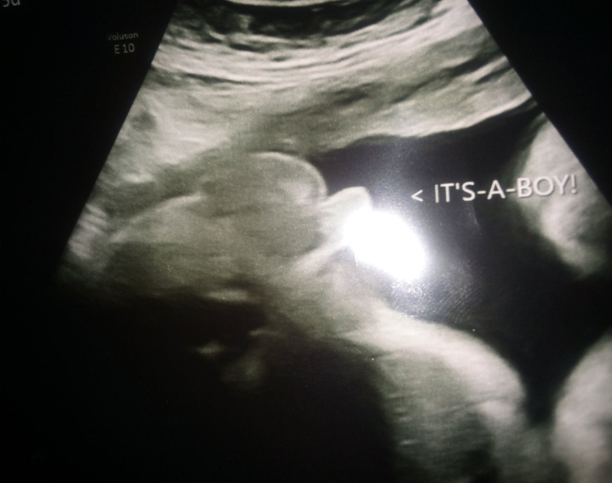 GabrielKill9's tweet image. M® • ]K i! I ][L•••Yesterdayz Over Tomorrow Starts Today••• Dropping Feb.17 2022 , A different kind of Monsta has stepped into the Rap Game ..