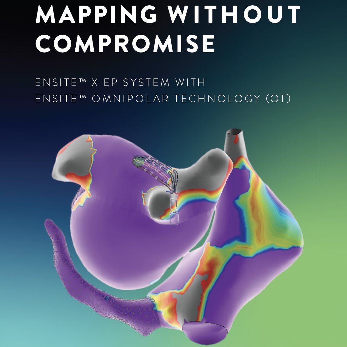 The wait is over, #EPeeps.

#EnSiteX with Omnipolar Technology is here. 

✔️ Powerful
✔️ Reliable
✔️Efficient

See what’s possible – #OnlyWithOT: cardiovascular.abbott/us/en/hcp/prod… 

Safety Info: cardiovascular.abbott/us/en/hcp/prod…