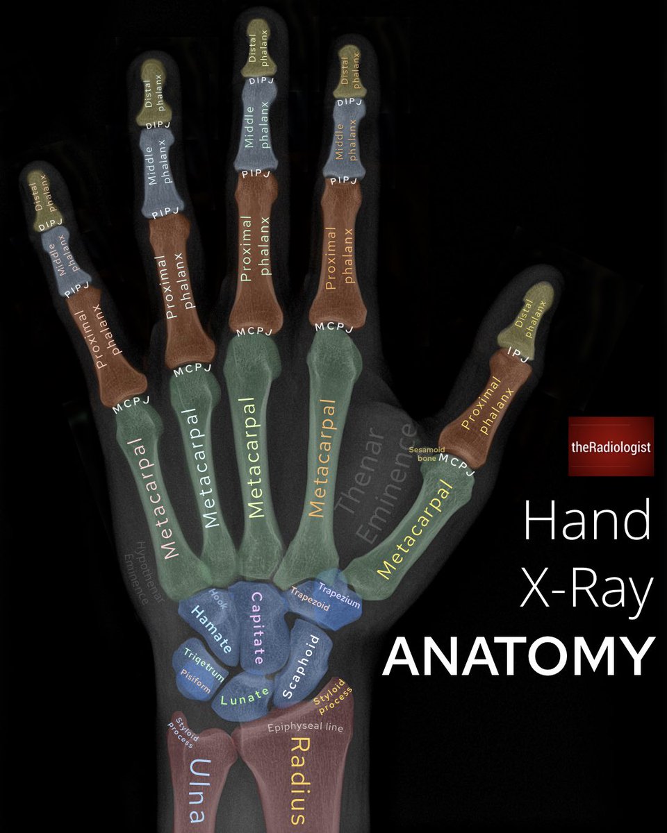 Hand X-ray anatomy