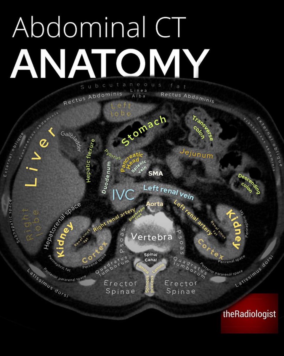 Super helpful abdominal CT anatomy schematic from <a href="/radiologistpage/">theRadiologist</a> ⬇️

#MedTwitter