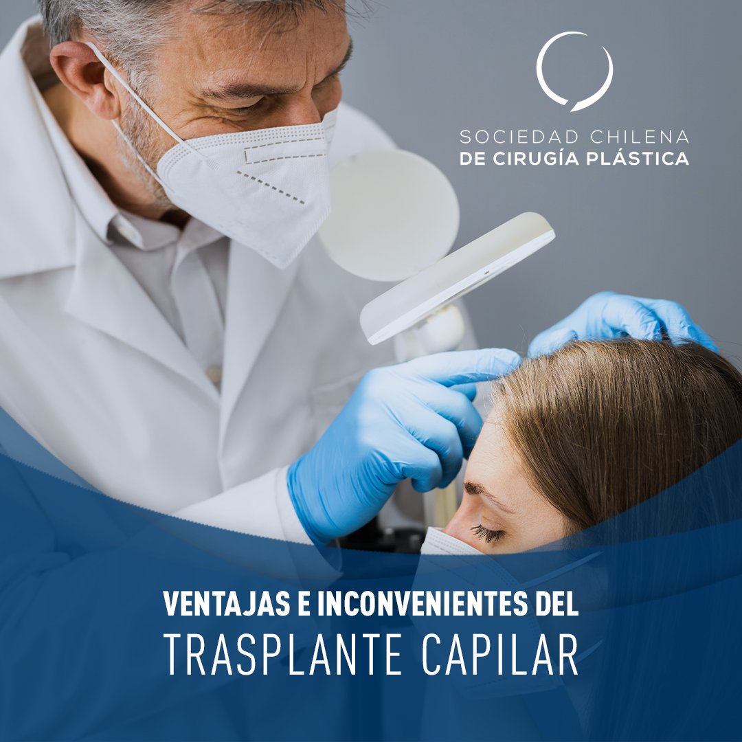 sccplastica's tweet photo. El trasplante capilar es una de las opciones más recurridas para solucionar la calvicie, tanto por hombres como mujeres. En el siguiente post te contaremos sobre algunas de sus ventajas y posibles inconvenientes. 
#SCCP  #QueTuCirujanoSeaPlástico https://t.co/KJx5vPkfPp