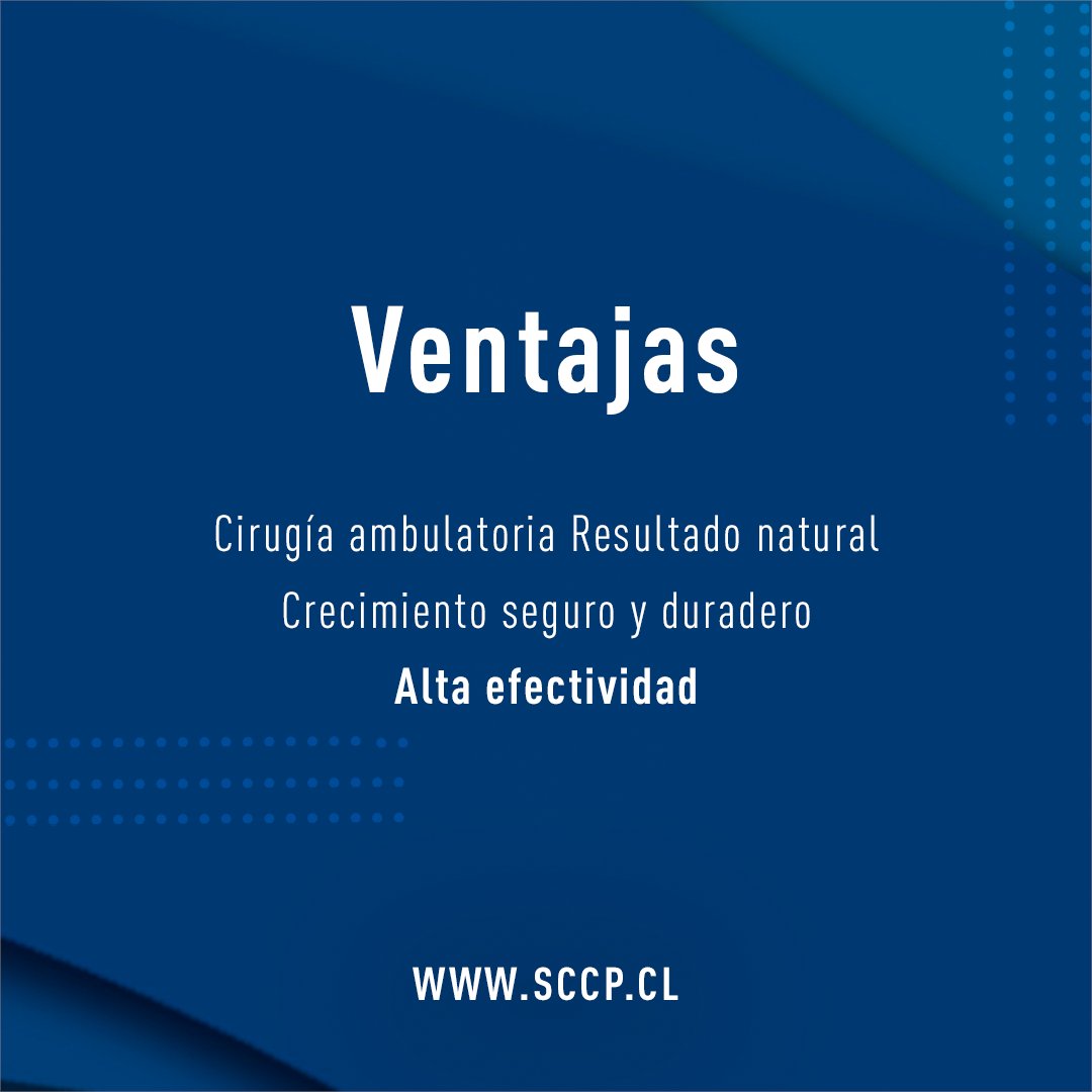 sccplastica's tweet photo. El trasplante capilar es una de las opciones más recurridas para solucionar la calvicie, tanto por hombres como mujeres. En el siguiente post te contaremos sobre algunas de sus ventajas y posibles inconvenientes. 
#SCCP  #QueTuCirujanoSeaPlástico https://t.co/KJx5vPkfPp