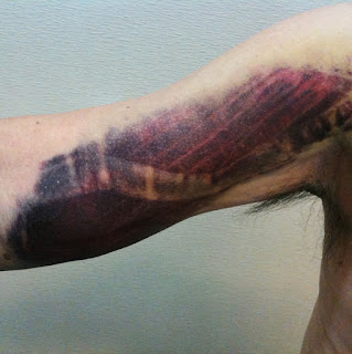 KinesioTape's tweet photo. Still Using Kinesio Tapes Even If Research Paper Says They Aren't Useful? If we use them correctly, they definitely work. | Read More: https://t.co/LzDVGYk9Nt #kinesiotape #research #kinesiotaping #kinesiotapingmethod #swelling #bruising #blog #painrelief #kinesio #tapewithwisdom https://t.co/SxWGFAlmwu