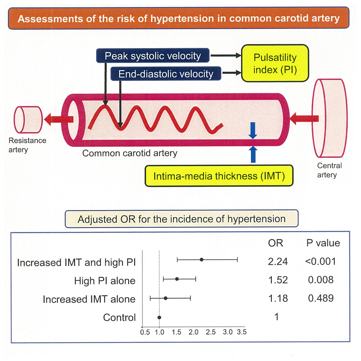 Common carotid artery parameters that can be easily evaluated using ultrasonography may help identify individuals at high risk of hypertension. In particular, pulsatility index is a better predictor.

ow.ly/CbgP50GPmKL