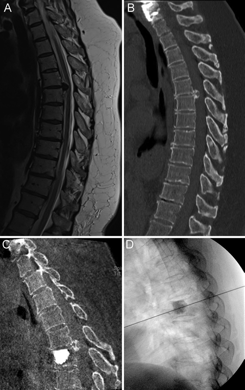 Journal of Neurosurgery tweet media