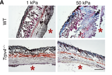 ScienceMagazine's tweet photo. A new study in @scisignal demystifies the mechanisms of the #ForeignBodyResponse and could facilitate the design of FBR-specific treatments or medical devices that avoid these harmful fibrotic responses. https://t.co/nDvsEMCzEe https://t.co/leRaduQoKB