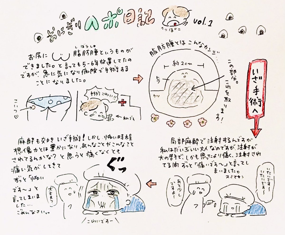 先日「脂肪腫」を摘出してきました!せっかくなんで日記にしました。よかったら読んでください!
ちなみにヘポとはヘッポコの略です(どうでもいいね!)

#マンガ #日記 