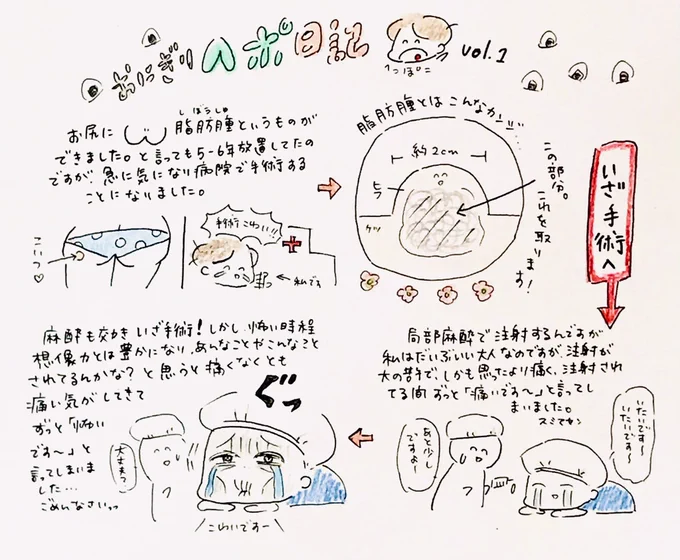 先日「脂肪腫」を摘出してきました!せっかくなんで日記にしました。よかったら読んでください!
ちなみにヘポとはヘッポコの略です(どうでもいいね!)

#マンガ #日記 