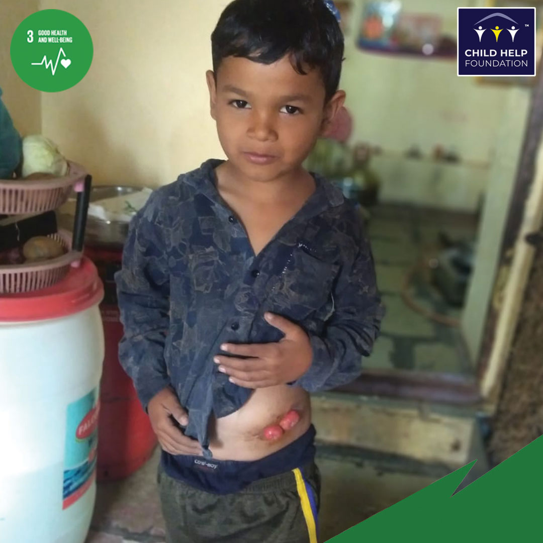 Childhelpindia's tweet photo. Shubham Mule is a 9 year old boy from Beed and is suffering from Anorectal malfunction and requires Colostomy Closure Surgery.
Please support his treatment: https://t.co/P4G76vYFar
#medicalsupport #emergencymedicalsupport https://t.co/3kLCIQH1Tk