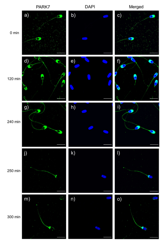 TechnoSperm's tweet photo. 📑🧪 Our latest published work explored the molecular role of Parkinson Disease Protein 7 (PARK7) during sperm in vitro capacitation.

El nostre darrer treball explora el paper que juga la proteïna PARK7 durant la capacitació in vitro d'espermatozoides. https://t.co/Wqz1QWW351