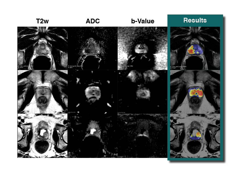Bot Image AI tweet media