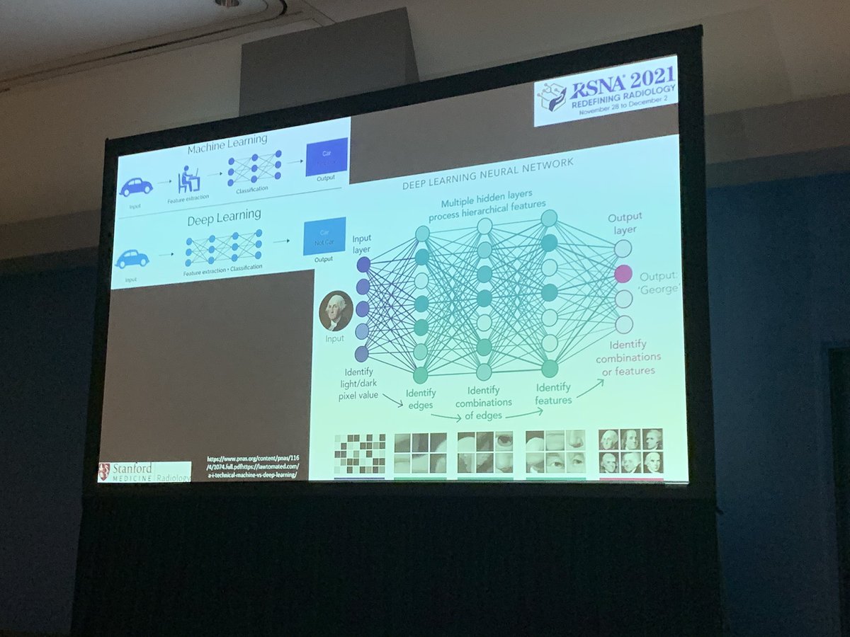 Lynne Martin from @Stanford_IR @StanfordHAI @StanfordRad speaks about use of #AI in #irad - Dr Martin is also the @SIO_Central #Hackathon winner! Great job!! @RSNA @WIIGS2 @womenirads