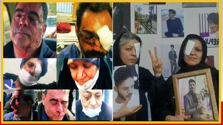 OmidiShiva's tweet photo. همبستگی مادران دادخواه آبان۹۸ با مجروحان اصفهان
مادر نوید بهبودی و مادر پژمان قلی‌پور  در همبستگی با مجروحان اصفهان، به‌طور نمادین هر کدام یک چشم خود را بسته‌اند و می‌گویند ما اجازه نمی‌دهیم که رنج و درد این عزیزان که فرزندان ما هستند، مسکوت بماند.
#اصفهان_تنها_نیست https://t.co/QRXuuj03VE
