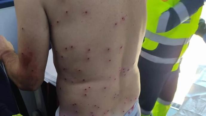 CiclismoInter's tweet image. Un cazador le disparó más de 100 veces a un ciclista tras confundirlo con un conejo: bit.ly/3par0hW #ciclismo