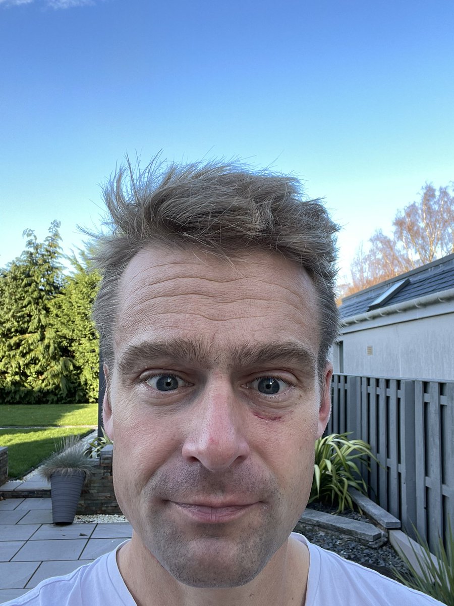 Told you. Those breaststroker’s are total BANDITS! My own fault … i should’ve seen *it* coming 🙋 Getting slow in many different ways these days it appears…