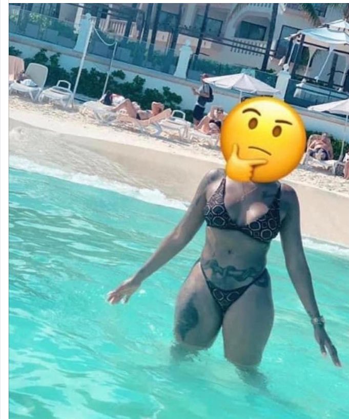 CrimsonRedPill's tweet photo. They just be puttin y’all #bellybutton ANYWHERE after #surgery‼️🤣🤣💀
#liposuction #bbl #fattransfer #Redsaid https://t.co/wflMHePPB5