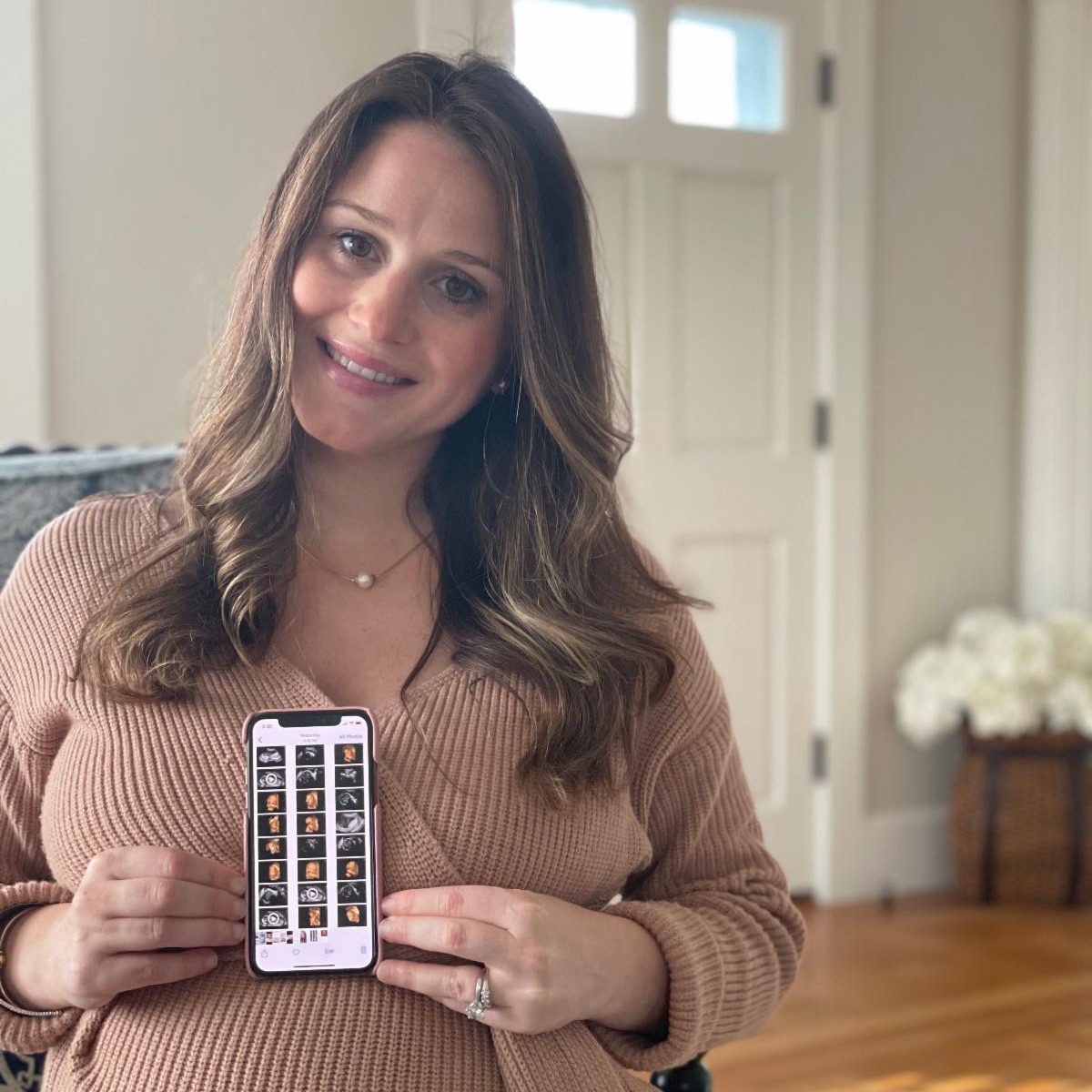 sonagram_'s tweet photo. Sharing ultrasound pictures and videos is quick and easy with Bellybaloo. Click the link in our bio to learn how you can get your ultrasound pictures straight to your phone! #bellybaloo #pregnant #pregnancy #sharethebeginning #shareyourbeginning https://t.co/LbFMpEFC0f