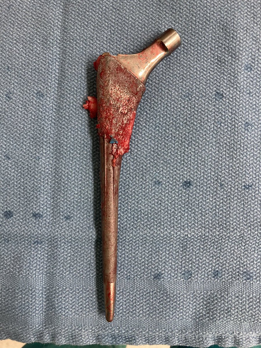 Terrific Tuesday continued…. #orthotwitter