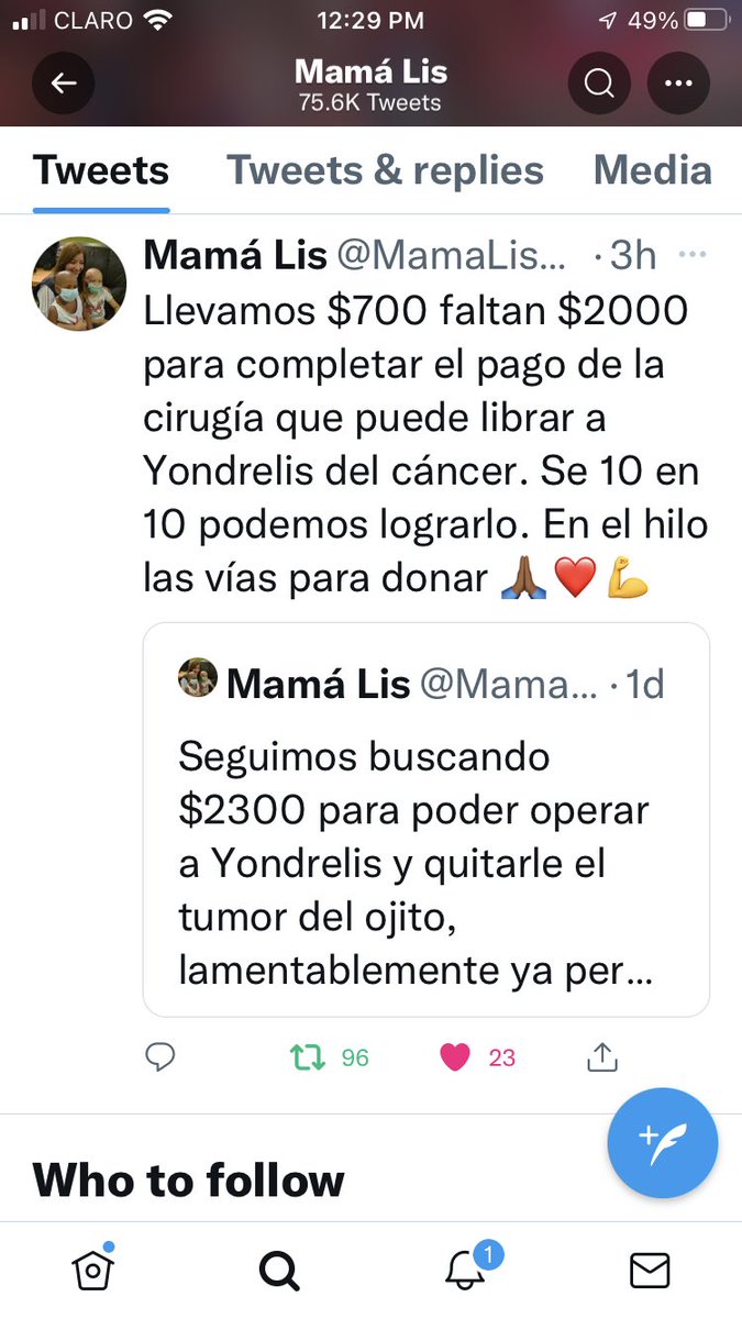 diana_rosenberg's tweet photo. 🆘Para lograr extraer tumor muy agresivo en ojo de Yondrelis,la bebé ya perdió su otro ojo,urgen $2000,el cáncer no espera,ésto es de vida o muerte👇info para donar en @MamaLisVzla y su gofundme.Dí sin falta que es para Nickol,su mamá @LuisOlavarrieta @jesusmedinae @Naky @LucyPN https://t.co/NSWpYmCqV0