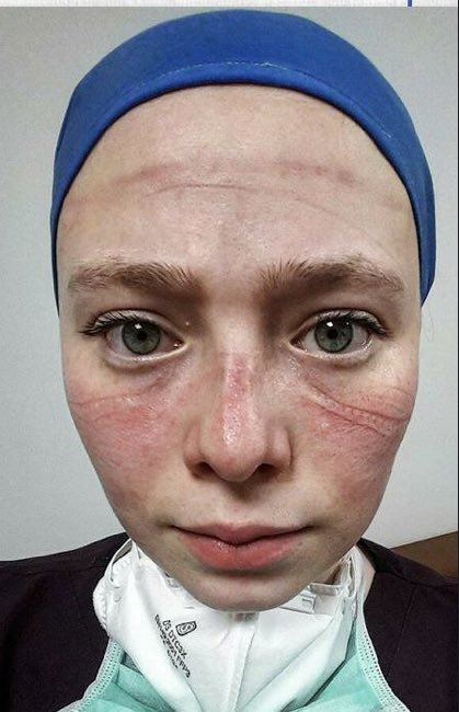 Pratisyen hekim ve uzmanlara yapılan zam iyi bir gelişme. Ancak salgında hastayla bire bir ilgilenen, ağır işçi şartlarında mesai yapan; başta hemşireler olmak üzere tüm sağlık çalışanlarına aynı iyileştirme yapılmalıdır. Şu fotoğraftaki arkadaşımız gibi nicelerine haksızlık olur