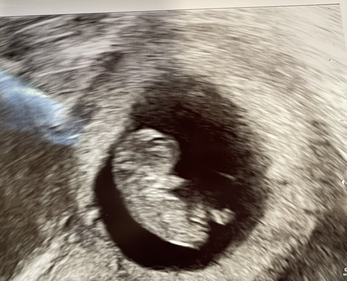 Ten weeks today and got to see my little peanut for the first time!! Thankful my job offers health insurance and wonderful benefits for my growing family! Everyday is take your kid to work day for me 😂 #LifeAtATT