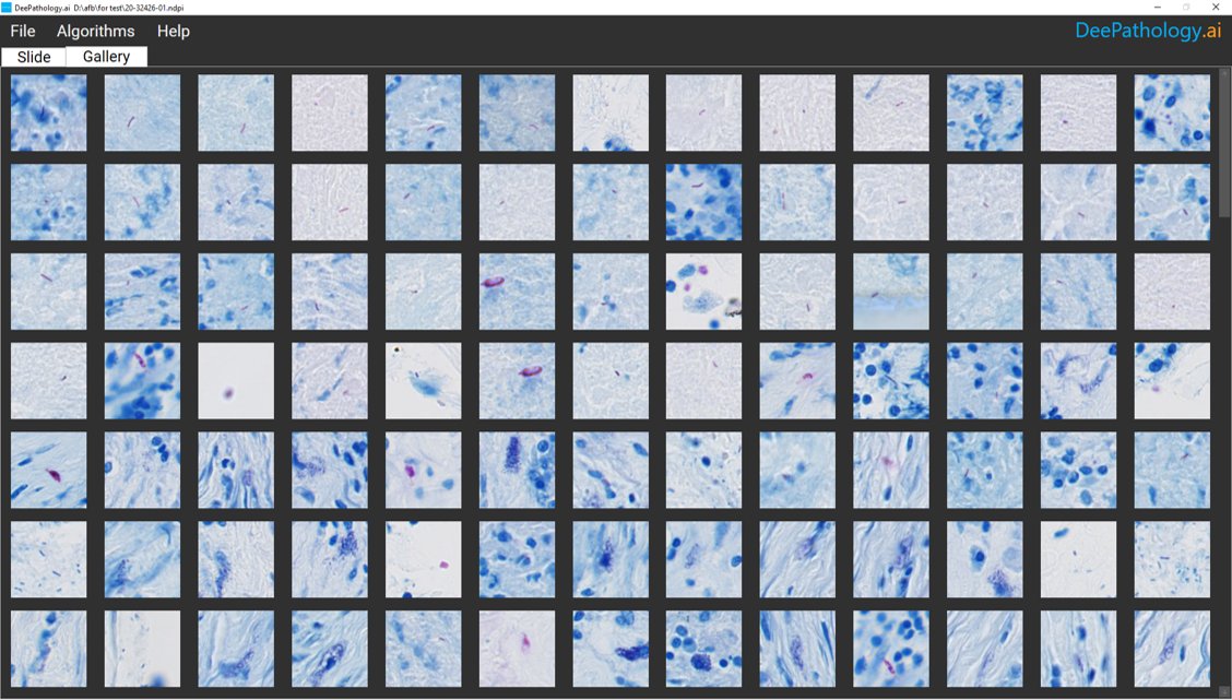 If you are visiting the <a href="/GlobalEngage/">Global Engage</a> Digital Pathology &amp; AI Congress: Europe today in London, we invite you to stop by the poster of <a href="/JoMoore/">jo moore</a> and <a href="/MoredunComms/">The Moredun Foundation</a> on "TB or not TB: automated detection of Mycobacteria in Ziehl-Neelsen stained histological sections".