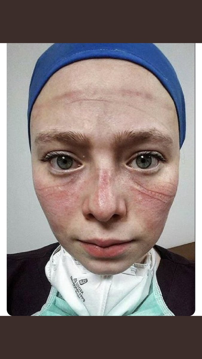 İzinler iptal edildi, tulumların içinde saatlerce ter döküldü,herkes hastaneye gelmeye korkarken hastane evimiz oldu, koronalı hastalar ev ev dolaşıldı bakım verildi. Aylarca virüs bulaşır diye eşinden çocuğundan ayrı yaşadı sağlık çalışanları. Hatırlatalım ! #fahrettinkoca