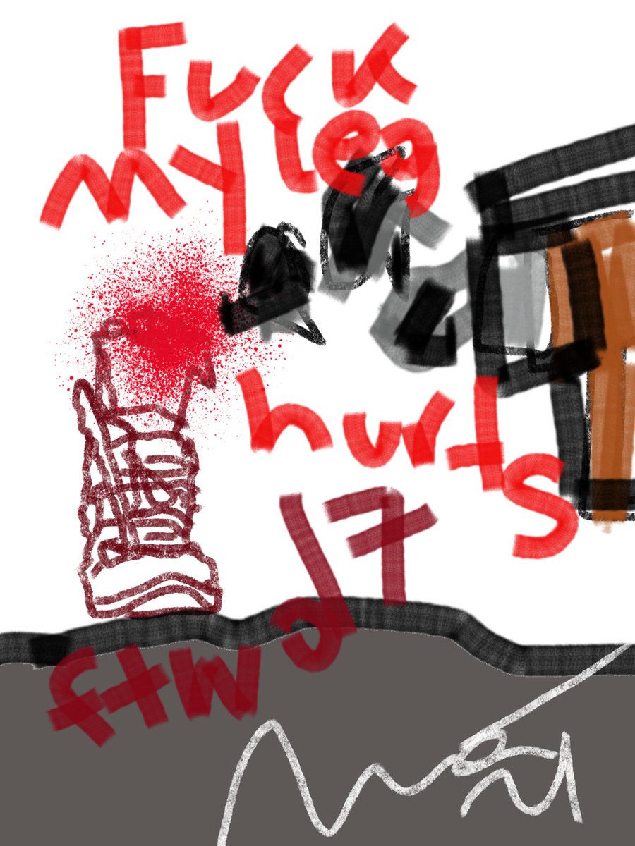 AlberDesigns's tweet image. Fuck my leg hurts...
Ftwd 7