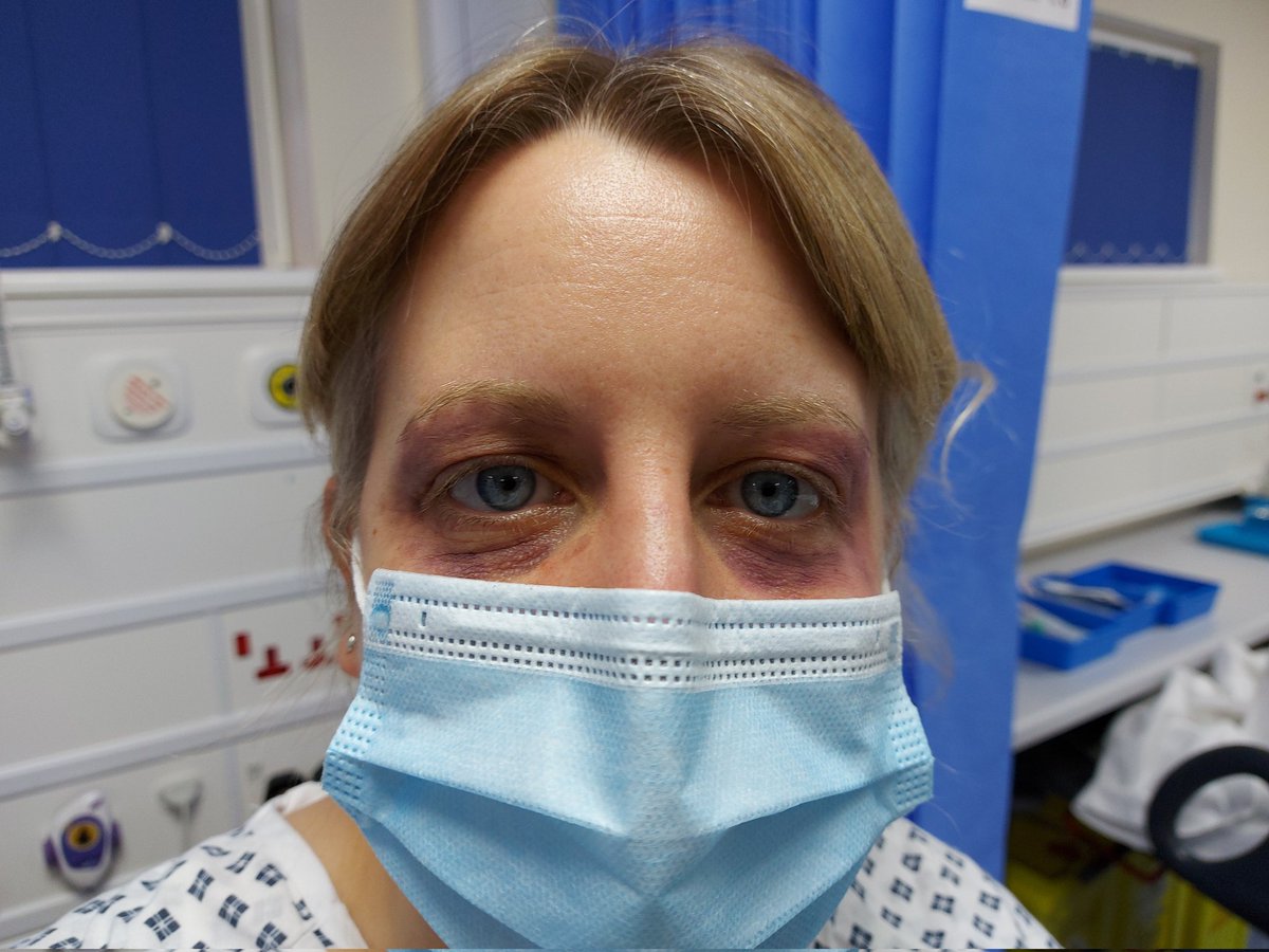 jesswickins's tweet photo. Honestly proud of my makeup skills #SIMSKILLS @UHBEducation https://t.co/nS9gCQyHjd