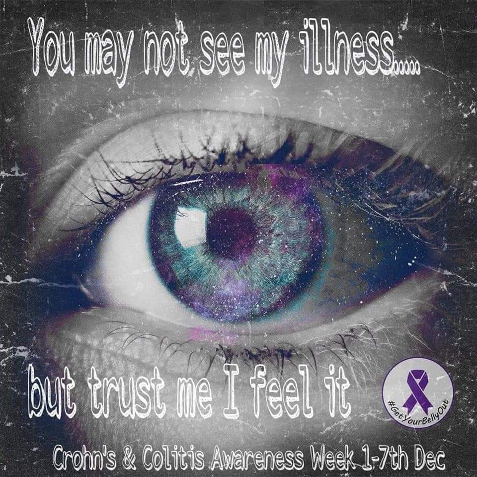 GetYourBellyOut's tweet photo. 🙋 Hands up - where are our #Crohns Disease / Ulcerative #Colitis / #IBD warriors at?? Feel free to give this tweet a cheeky share seen as it's 
#CrohnsandColitisAwarenessWeek 💜 https://t.co/h3Ns0vbrmH