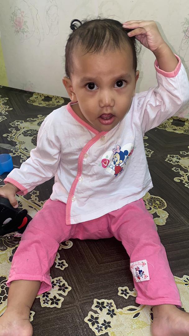 sharlinsarah's tweet photo. Adik Putri alami sakit Cleft Palate yang menyebabkan kesan pada pendengaran dia. Doktor ada sarankan buat operation kecil susulan dekat gegendang telinga dia utk masukkan tiub kecil. Fungsinya nak bagi cecair belakang telinga tu keluar. https://t.co/nzOQTMT110