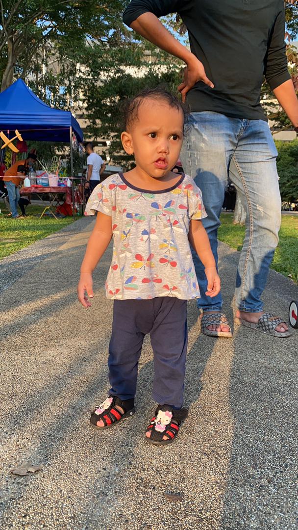 sharlinsarah's tweet photo. Adik Putri alami sakit Cleft Palate yang menyebabkan kesan pada pendengaran dia. Doktor ada sarankan buat operation kecil susulan dekat gegendang telinga dia utk masukkan tiub kecil. Fungsinya nak bagi cecair belakang telinga tu keluar. https://t.co/nzOQTMT110