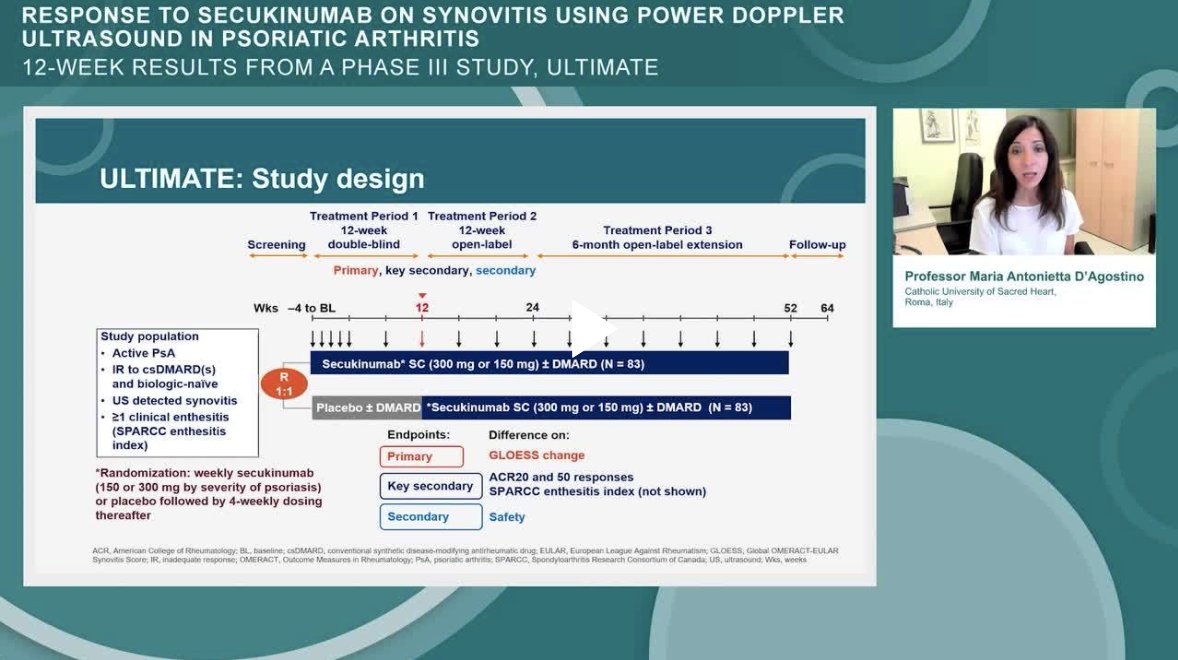 NEW: D’Agostino et al. use Power Doppler #ultrasound to investigate the response of synovitis to IL-17A inhibition with secukinumab in patients with active PsA. 

Watch Prof D’Agostino provide an overview of the study in our first video abstract 🤩

👉 bit.ly/3rzBD0J