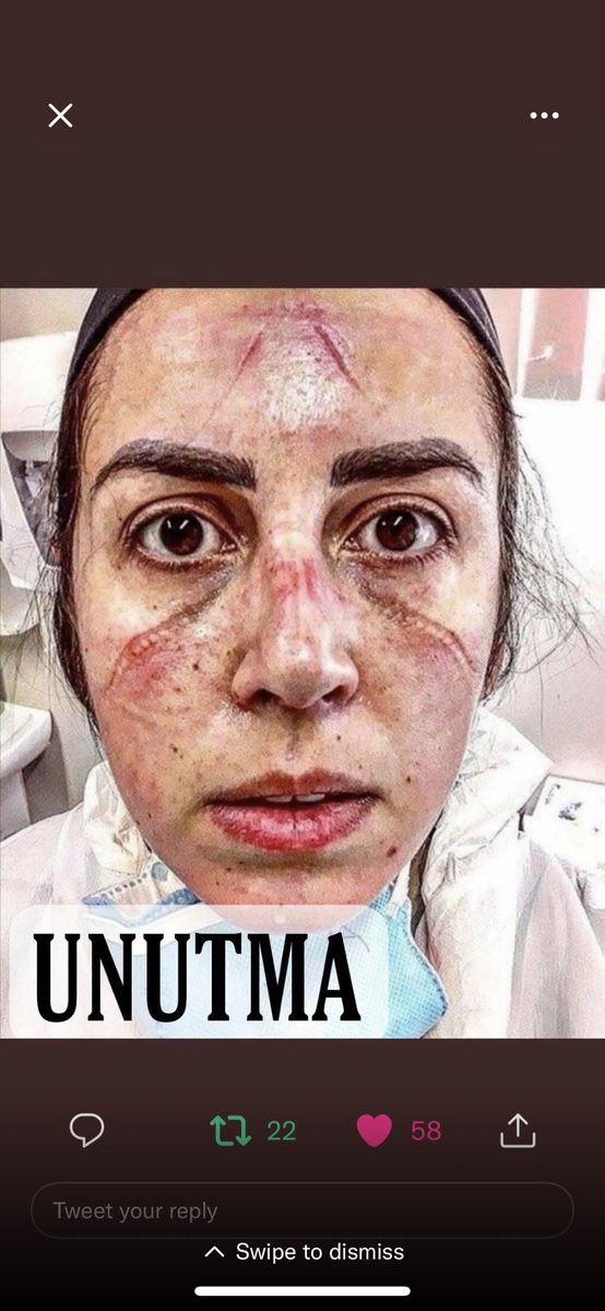 #fahrettinkoca
hekim "DIŞI" personeller kim oluyor diye soranlar olmuş buyrun !
#hekimdışı