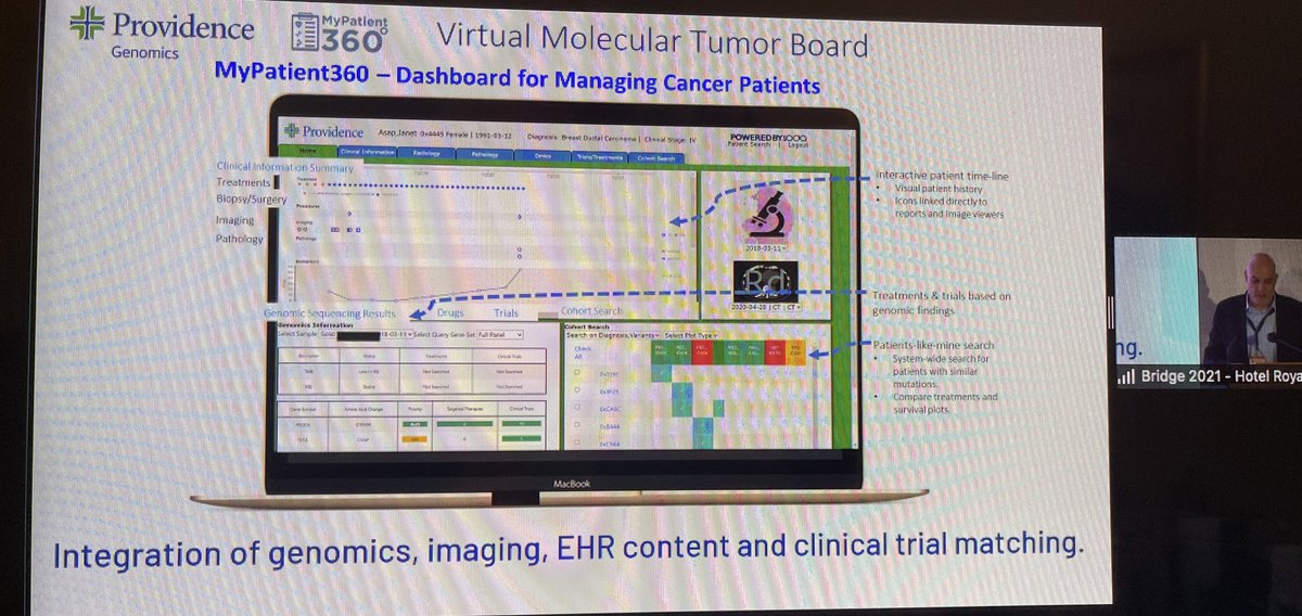 BernardAFox's tweet photo. Prof @carlobifulco #molecular #pathology ROCKSTAR @ChilesResearch @providence AMAZING! Describes work with @Microsoft & ODA 2 build virtual molecular #tumor board & underscores how critical it is 2 delivery of optimal #cancer treatment @FondMelanoma #IOBridge2021 @PAscierto https://t.co/BVG24KZ4jo