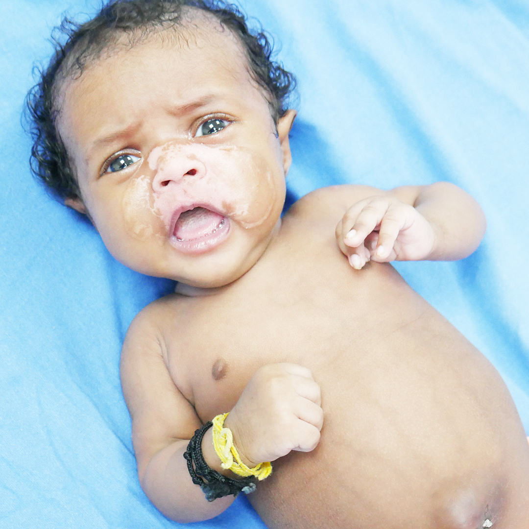 ketto's tweet photo. "The same deadly disease that took my son's life when he was only 8-mo is now threatening to snatch my 2-mo baby girl from me. Plagued by recurrent bloodstream and ear infections, she is struggling to live, and I cannot afford her BMT."

Please help: https://t.co/0v2ULa4U6D https://t.co/WWOOquBNiC