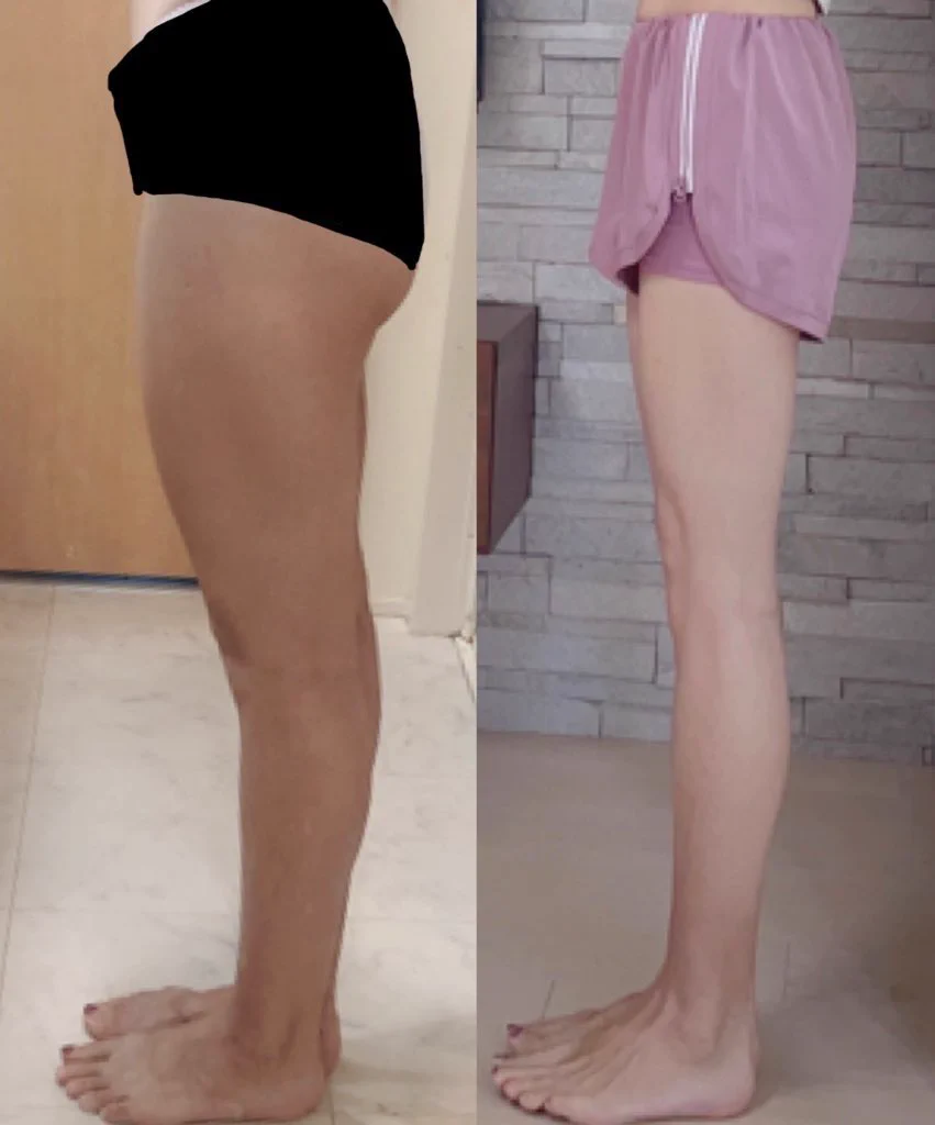 裏ももを鍛えると足痩せする？！日常生活に取り入れてみて！