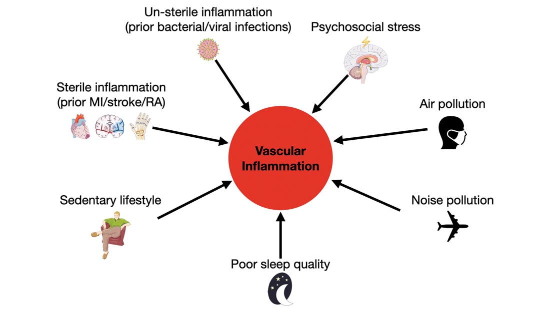 LiebertPub's tweet photo. New study identifies the impact of acute and chronic #psychosocialstress on #vascularinflammation, as psychosocial factors are increasingly acknowledged as risk factors for #cardiovasculardisease and #atherosclerosis: https://t.co/NcvY06WEA4 https://t.co/NTk8djwAdc