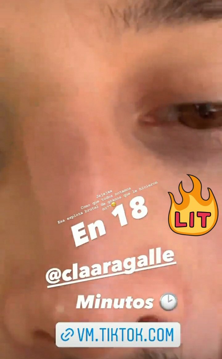 LauraSalz16's tweet photo. #EnReunion 😳😳😳

No puedo oir. Sólo pispeo

Pero qué asesinaaaaaaaaa
Dale respiroo.🐍🤣
Jodeme q se presentó al live en estas condiciones? 😳🔥😆😆😆 

Pega fuertee el 🌞🌞🌞🌞🌞🔥🥰💞👏👏👏👏👏 https://t.co/ggvEjBDnDa